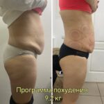 Результат программы похудения
